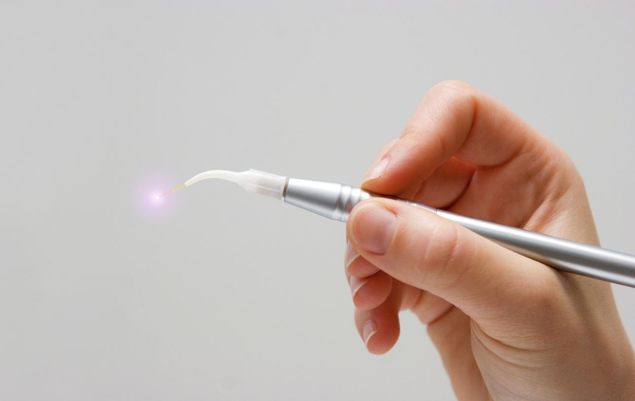Lasers in Dentistry Precision Dentistry in the Modern World