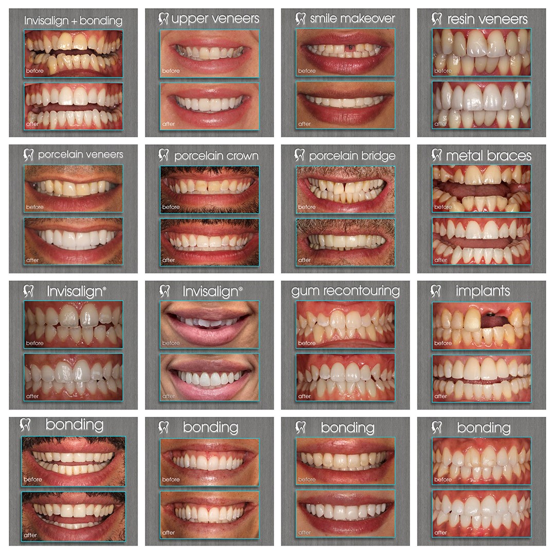 Dental Gallery